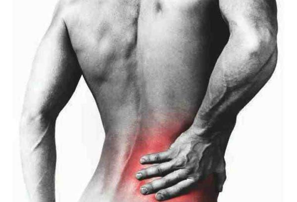 Πότε χρειάζεται νυστέρι η κήλη στο δίσκο