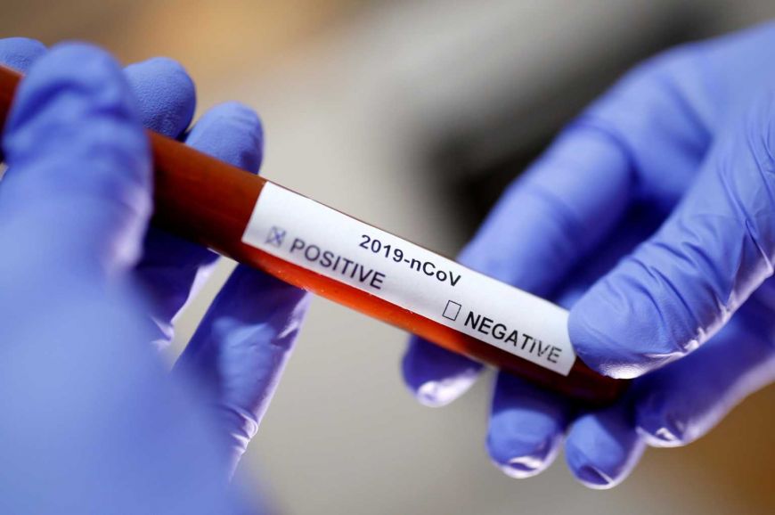 Κορονοϊός: «Κύκλωσε» τη χώρα ο ιός – Πού εντοπίζονται τα 153 νέα κρούσματα