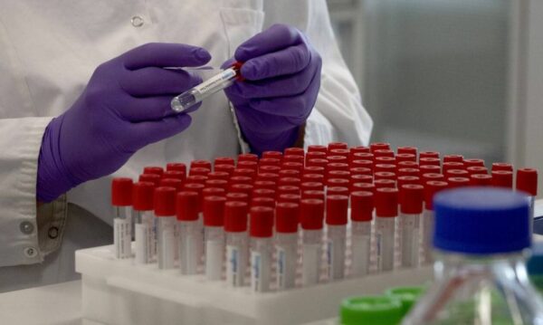 Κορονοϊός: 1240 νέα κρούσματα σήμερα 15/12 στην Ελλάδα