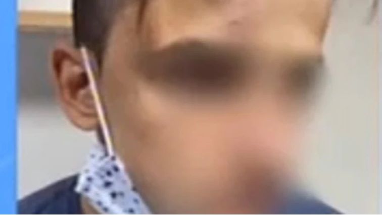 Γαλάτσι: Σοκάρει νέα υπόθεση ξυλοδαρμού ανηλίκου – 20 άτομα χτυπούσαν έναν 17χρονο