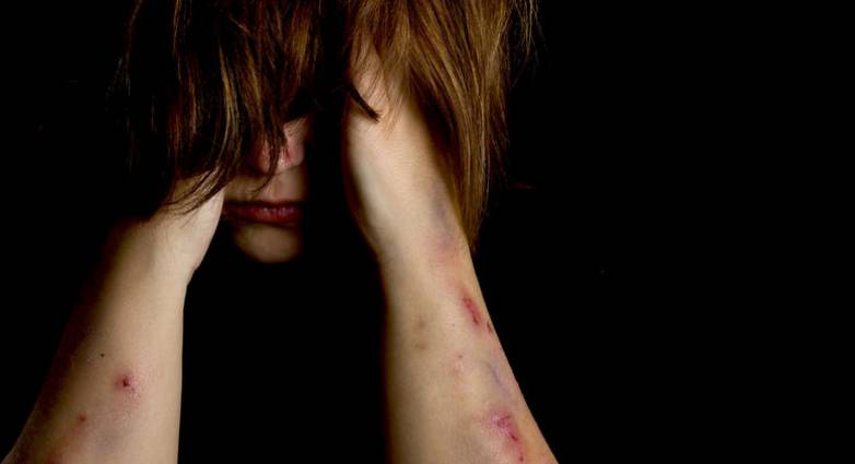 Μαρτύριο για 23χρονη στην Πάτρα -Την απήγαγε ο πρώην της! Την χτυπούσε στο σπίτι του επί 4 μέρες