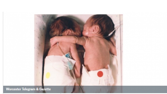 Η ιστορία της αγκαλιάς των διδύμων που γεννήθηκαν πρόωρα το 1995 και έγιναν viral το 2020