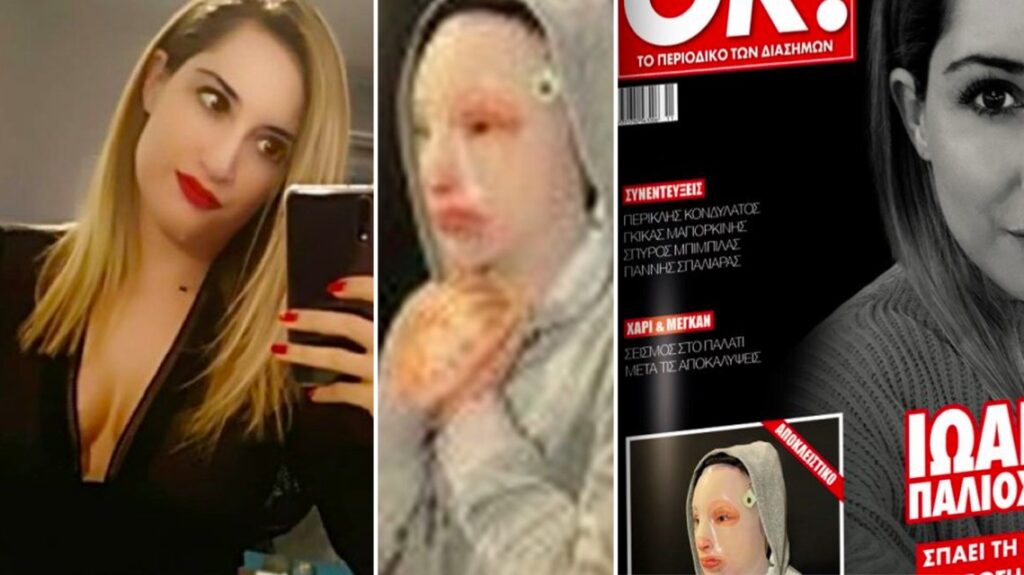 Γιατρός Ιωάννας: Ο λόγος που η Ιωάννα φοράει μάσκα, τα ειδικά ενδύματα για το σώμα της και η απαγόρευση για έναν χρόνο