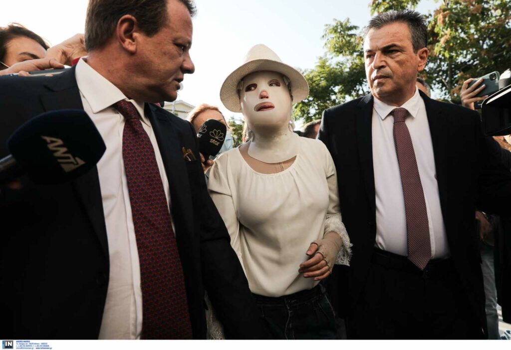 Επίθεση βιτριόλι: Δύο ακόμα άτομα εξετάζονται ως συνεργοί της 36χρονης – Η κίνηση που τους πρόδωσε