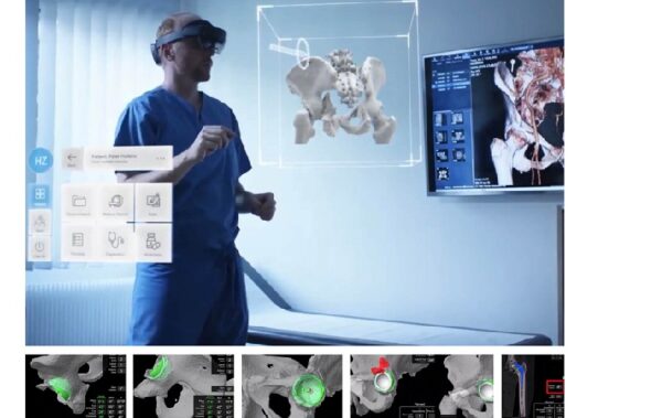 Νέα εποχή για τις αρθροπλαστικές γόνατος και ισχίου