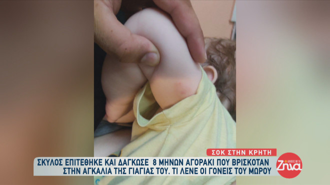 Σοκάρει η εικόνα βρέφους μετά από επίθεση λυκόσκυλου: Η μάνα μου μού έφερε το παιδί μέσα στα αίματα…