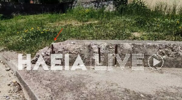 5χρονη με κάταγμα στο κρανίο- Χτύπησε στην παιδική χαρά σε σίδερο που εξείχε στο τσιμέντο- Λίγο έλειψε να χάσει το μάτι της