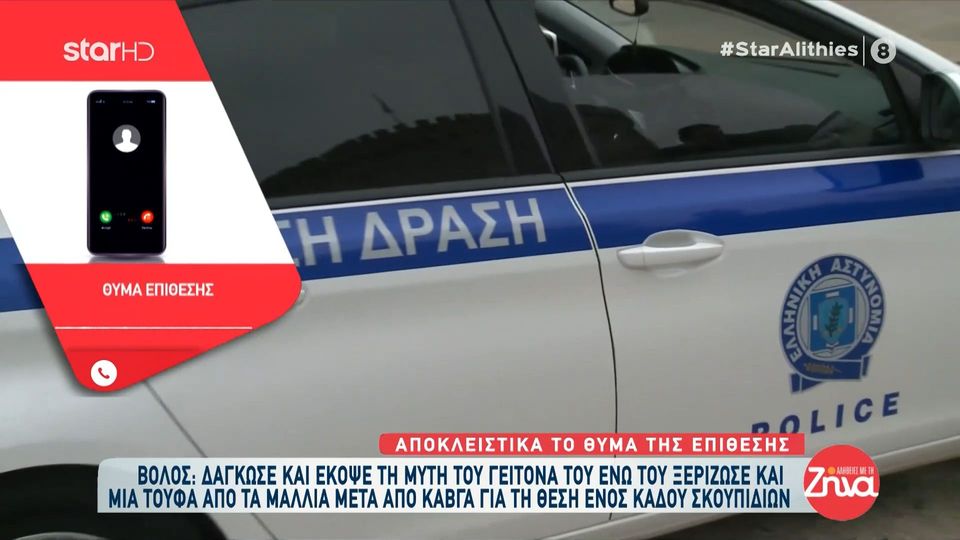 45χρονος καταδικάστηκε γιατί  δάγκωσε γείτονά του:  Όταν τα δόντια του καρφώθηκαν μέσα στη μύτη μου, του είπα…