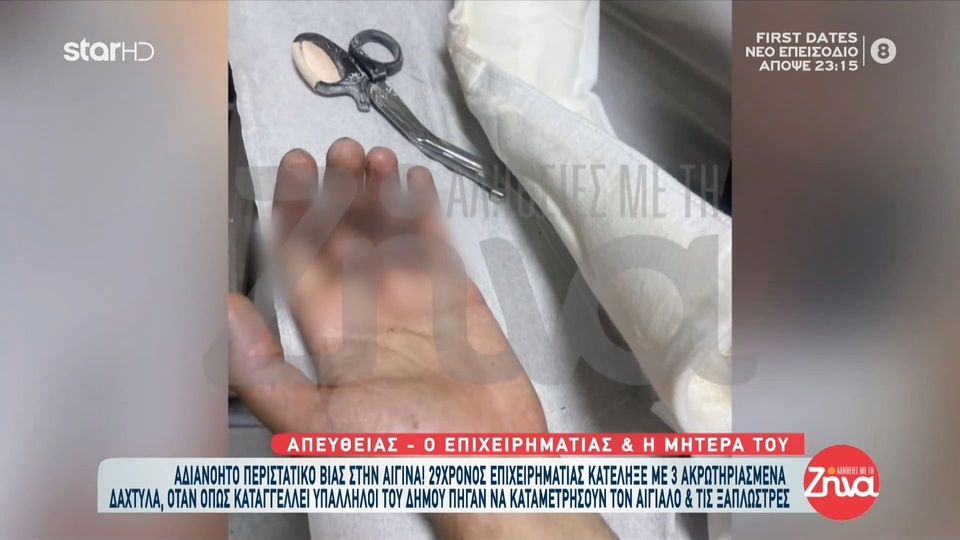 Απίστευτο περιστατικό στην Αίγινα: 29χρονος επιχειρηματίας κατέληξε με 3 ακρωτηριασμένα δάχτυλα