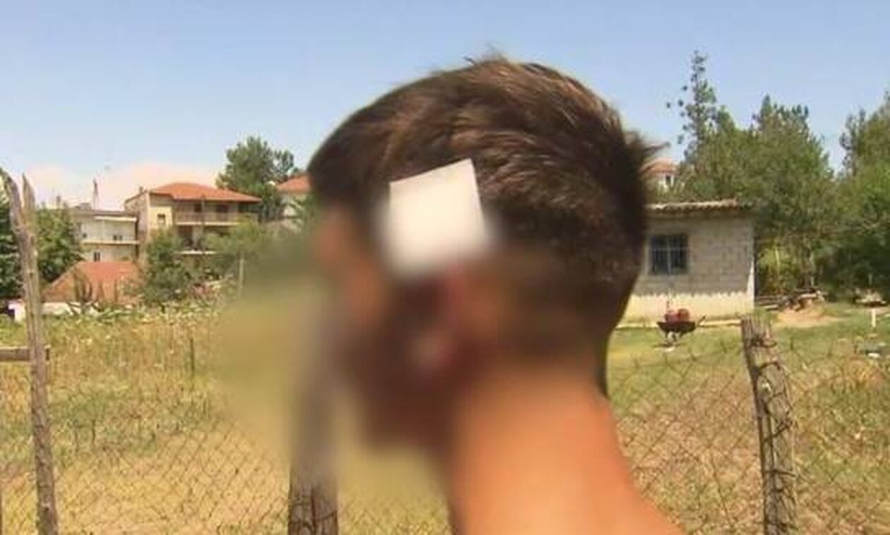 Ολυμπιάδα Χαλκιδικής: Ανησυχία και φόβος επικρατεί μετά τον τραυματισμό τριών ανηλίκων από πυροβολισμό με καραμπίνα