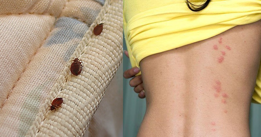 Πώς θα καταλάβετε ότι το σπίτι σας δέχεται «επίθεση» από κοριούς