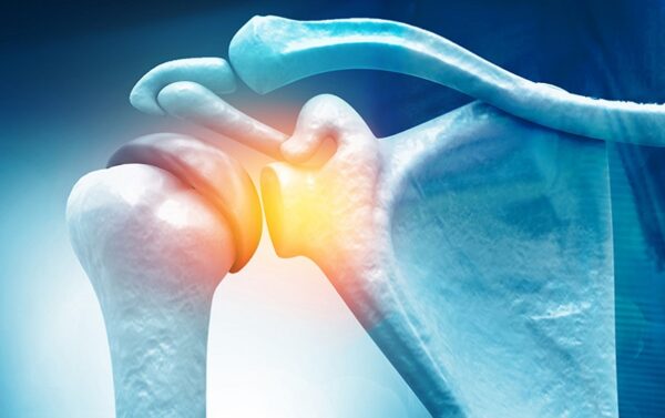 Αρθροσκόπηση Ώμου: Πώς επιδιορθώνει τις ρήξεις;