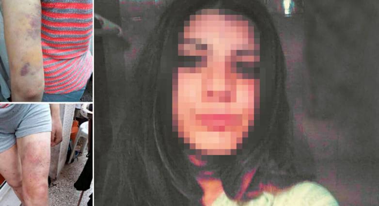Φαίη Μπακογιώργου: Αναπαράσταση της δολοφονίας ζητά ο πατέρας της – Τι δείχνουν τα ιατροδικαστικά ευρήματα – Κατηγορείται Πατρινή