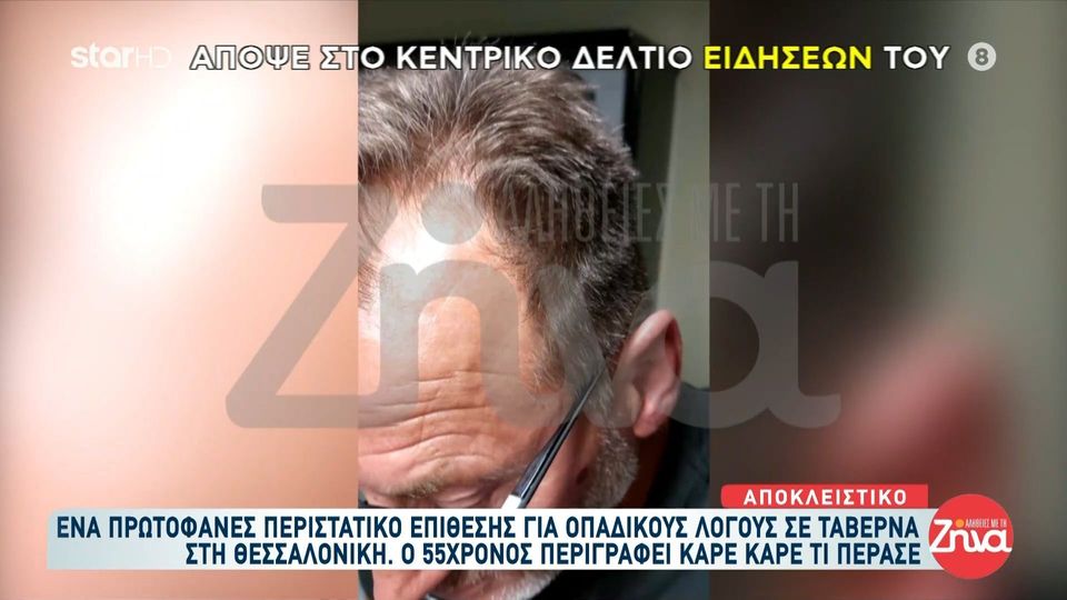 Πρωτοφανές περιστατικό οπαδικής επίθεσης σε 55χρονο σε ταβέρνα: Με έριξαν κάτω και με χτυπούσαν 20 άτομα με δολοφονικό τρόπο…