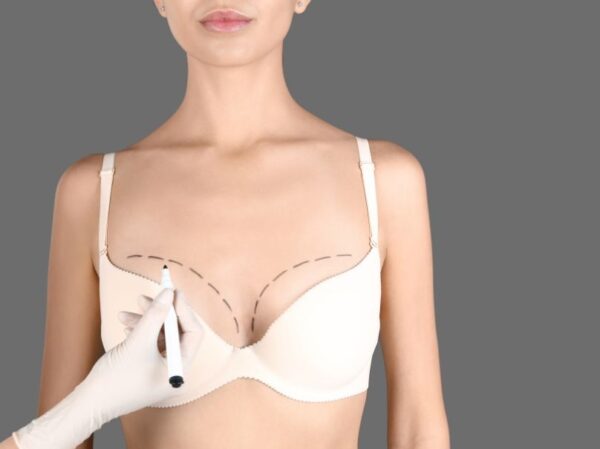 Αυξητική μαστών και ανόρθωση στο ίδιο χειρουργείο για φυσικό αποτέλεσμα