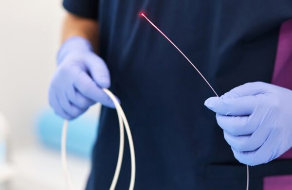 Ενδοαυλική θεραπεία με laser: Αντιμετώπιση κιρσών και φλεβικής ανεπάρκειας