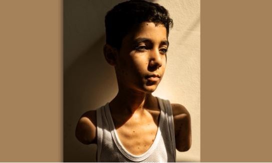 World Press Photo: Γροθιά στο στομάχι η φωτογραφία της χρονιάς με τον μικρό Παλαιστίνιο που έχασε και τα δύο του χέρια στη Γάζα