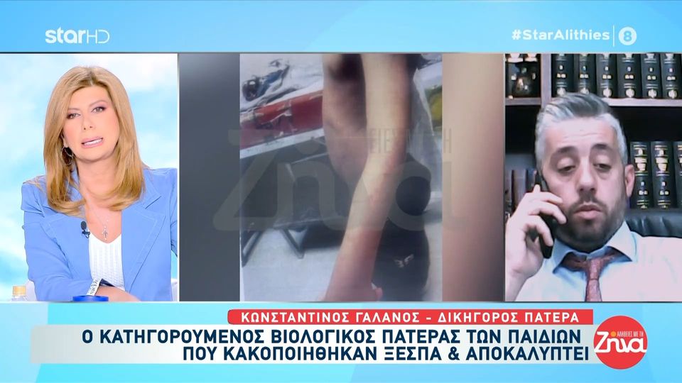 Φρίκη στη Λάρισα με τα δυο αδελφάκια που βρέθηκαν κακοποιημένα και καμένα με τσιγάρα: Όταν είδα τις φωτογραφίες και τις δερματικές βλάβες των παιδιών, πραγματικά σοκαρίστηκα…