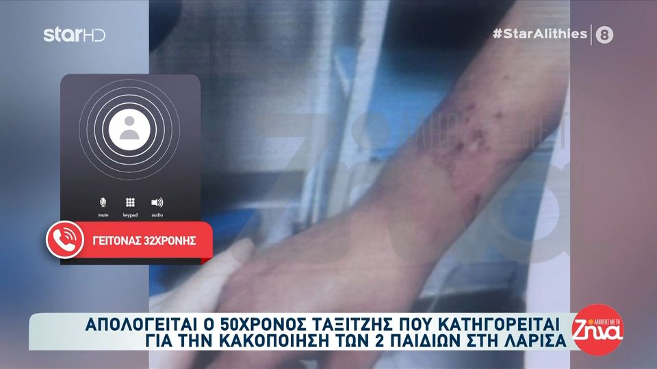 Κακοποίηση παιδιών στην Λάρισα: Τα παιδιά ήταν βρώμικα και απεριποίητα. Η μητέρα για τα σημάδια τους μας είχε πει πως ήταν αλλεργία…