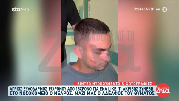 Video ντοκουμέντο: Άγριος ξυλοδαρμός 19χρονου από 18χρονο για ένα Like