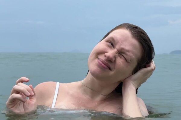 Νόσος του Κολυμβητή: Όταν το καλοκαίρι γίνεται επώδυνο για τα αυτιά