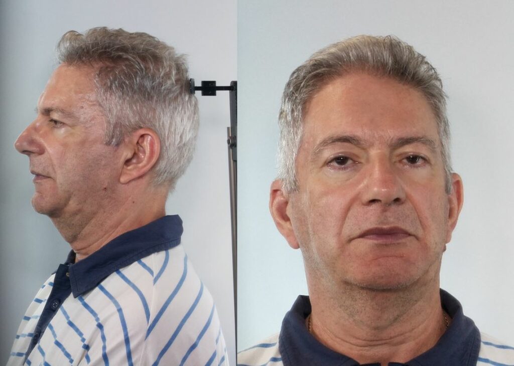 Αυτός είναι ο Χανιώτης γιατρός της κατασκήνωσης που κατηγορείται για ασέλγεια σε παιδιά