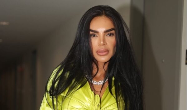 Τρομακτική μεταμόρφωση για μοντέλο από τη Βενεζουέλα: Φοράει κορσέ 23 ώρες την ημέρα και μείωσε 50 εκατοστά τη μέση της