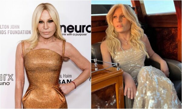 Donatella Versace: Πώς ήταν και πώς έγινε – Σοκάρουν οι φωτογραφίες μετά τις νέες πλαστικές
