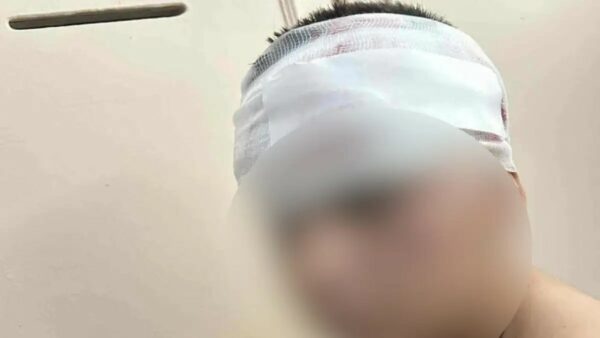 Θεσσαλονίκη: Συγκλονίζει ο πατέρας του 13χρονου που ξυλοκοπήθηκε- «Λείπει κομμάτι από το κεφάλι του»