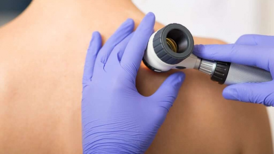 Η σημασία της τακτικής δερματολογικής εξέτασης