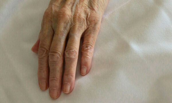 Άγριος εφιάλτης για 85χρονη στην Αιτωλοακαρνανία: Ξυλοκοπήθηκε ανελέητα για 100 ευρώ