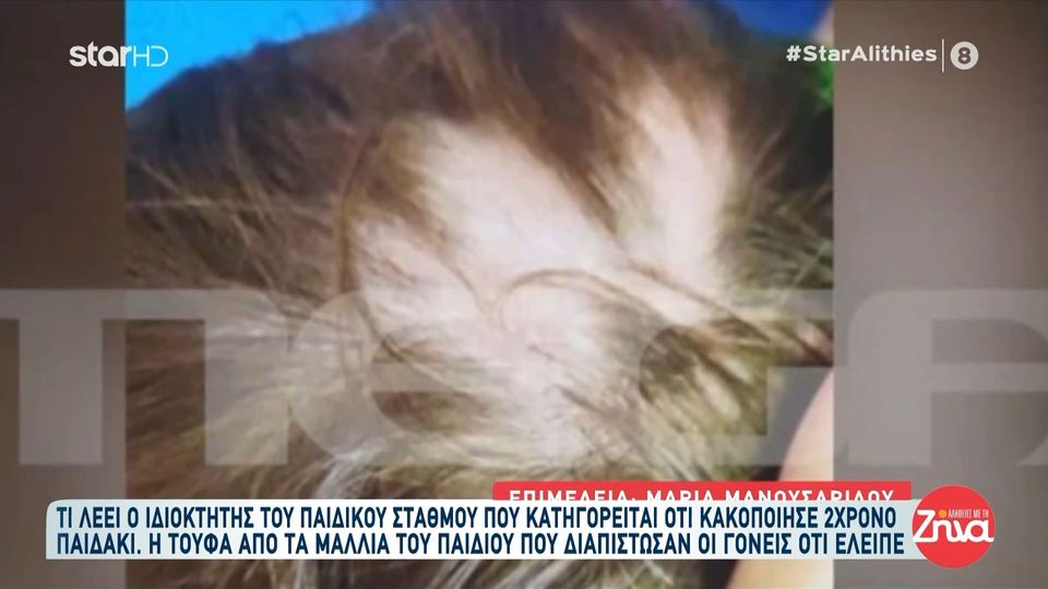 Ιδιοκτήτης παιδικού σταθμού που κατηγορείται για κακοποίηση τρίχρονου αγοριού: Έγινε ατύχημα…