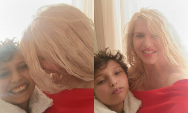 Τορίνο: Με επιτυχία πραγματοποιήθηκε η μεταμόσχευση ήπατος στον 18χρονο Μάριο