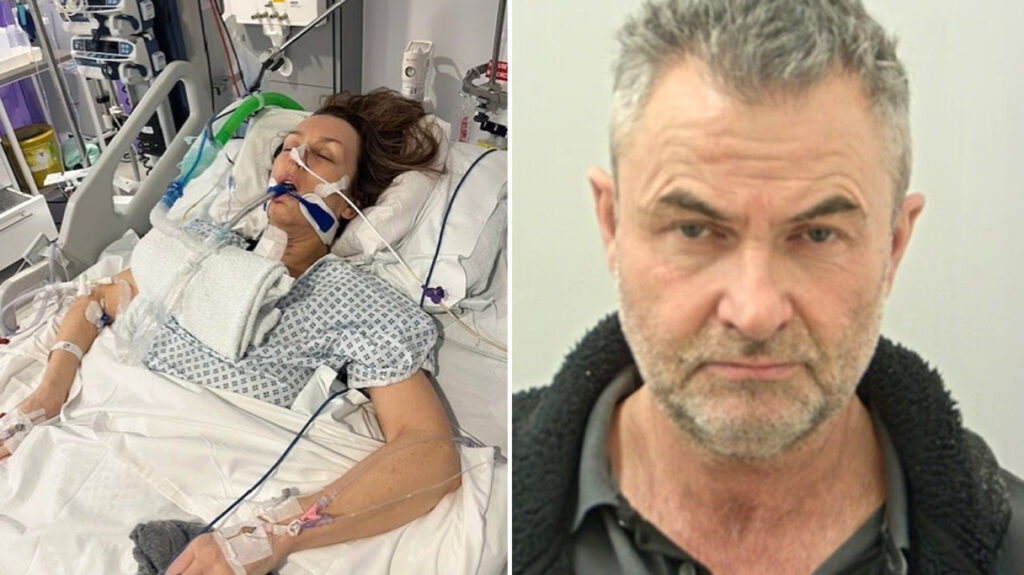 Παράλυτη για πάντα 57χρονη μετά τον άγριο ξυλοδαρμό από τον σύντροφό της – Της έσπασε το λαιμό όταν του είπε ότι θα τον άφηνε