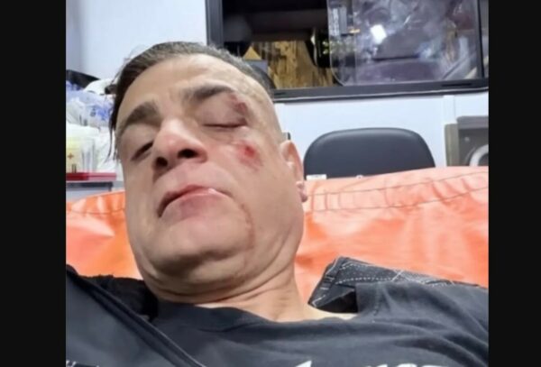 Άγριος ξυλοδαρμός Youtuber στο μετρό της Ρώμης – Του επιτέθηκαν οι πορτοφολάδες που βιντεοσκοπούσε, δείτε βίντεο