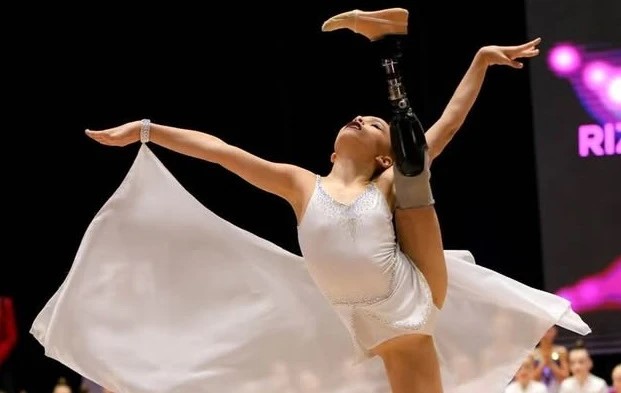 Στα 7 της έχασε το πόδι της σε πυραυλική επίθεση – Τώρα στα 9 της χρόνια κέρδισε μετάλλιο στη μεγαλύτερη διοργάνωση ενόργανης στην Ουκρανία