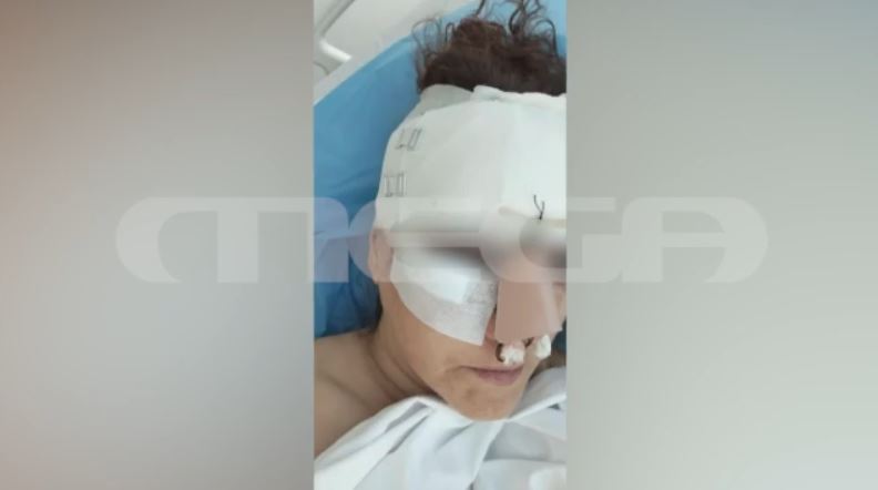 Θεσσαλονίκη- Συγκλονίζει η 45χρονη που τραυματίστηκε στο εμπορικό κέντρο «Μου κάνανε δύο στρώσεις με ράμματα, έχει διαλυθεί το πρόσωπό μου»
