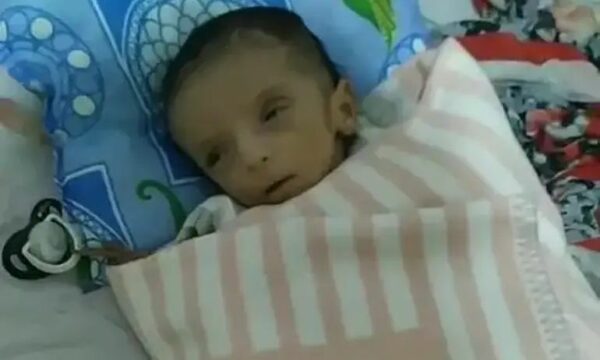 Πέθανε από την πείνα βρέφος 2 μηνών – «Είδαμε ότι ήταν νεκρό, ετοιμάσαμε φαγητό και φάγαμε»