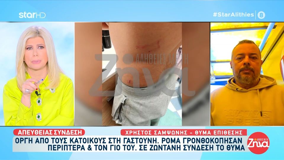 Ιδιοκτήτης περίπτερου στη Γαστούνη που έπεσε θύμα ξυλοδαρμού με τον γιο του από 20 Ρομά: Θα το κλείσω, δεν αντέχω άλλο φοβάμαι!