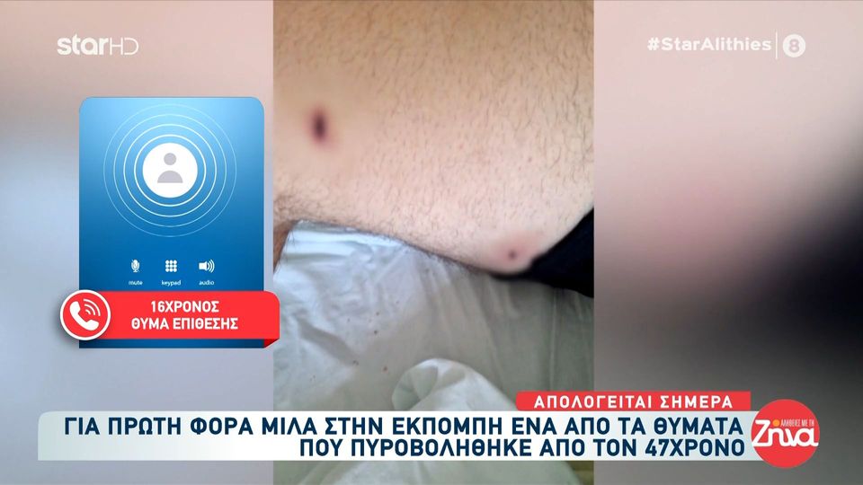 Συγκλονίζει ο 16χρονος που πυροβολήθηκε με τους φίλους του από 46χρονο στο Αίγιο: Αυτό που έκανε ήταν απάνθρωπο. Δεν με νοιάζει αν το έχει ξανακάνει, με νοιάζει αυτό που έκανε σε μένα και τους φίλους μου…