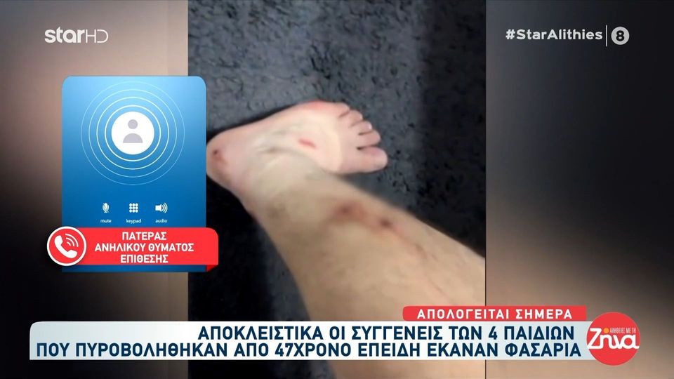 Πατέρας ανήλικου που δέχτηκε πυρά από 45χρονο στο Αίγιο: Το παιδί μου είπε “μας πυροβόλησαν…”. Τα σημάδεψε και έριξε…