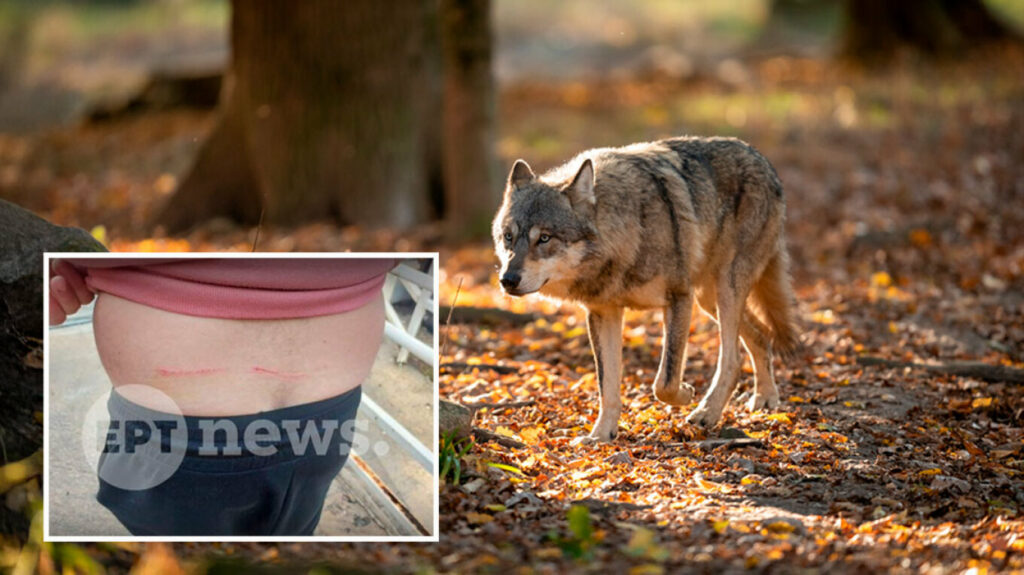«Μου έσκισε τη μπλούζα και μου έκανε γρατζουνιές»: Πώς σώθηκε ο άνδρας που δέχθηκε επίθεση από λύκο στο Τατόι