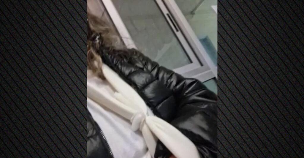 «Αν δεν ήταν η κόρη μου θα με είχαν κατασπαράξει», λέει η γυναίκα που δέχθηκε επίθεση από αδέσποτα σκυλιά στην Πυλαία