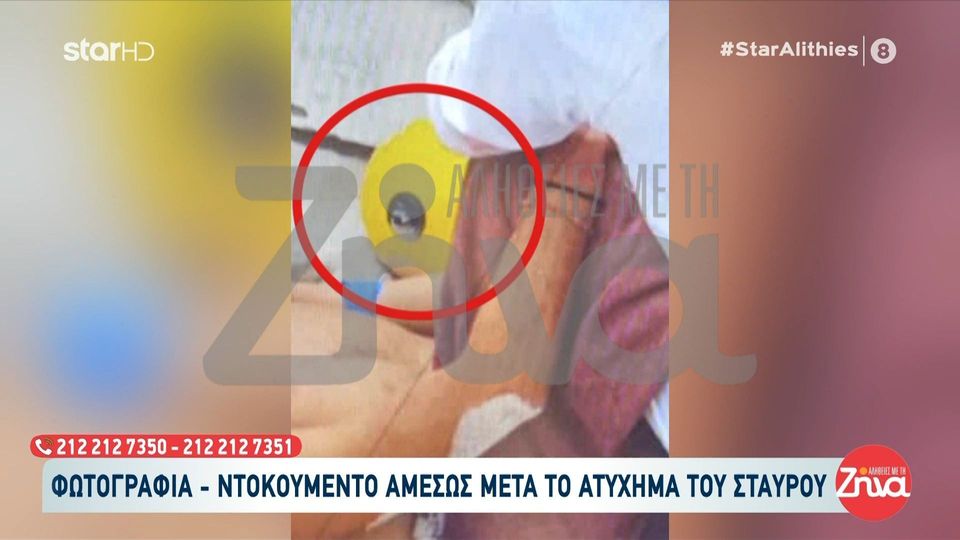 Survivor: Δείτε για πρώτη φορά  φωτογραφία-ντοκουμέντο αμέσως μετά το ατύχημα του 22χρονου Σταύρου