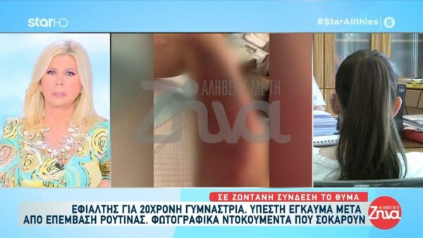 Συγκλονίζει η 20χρονη γυμνάστρια που υπέστη έγκαυμα κατά τη διάρκεια χειρουργικής επέμβασης: «Ο γιατρός μου έριξε στην πληγή ένα υγρό και μετά από λίγα λεπτά μύρισα καμμένο»