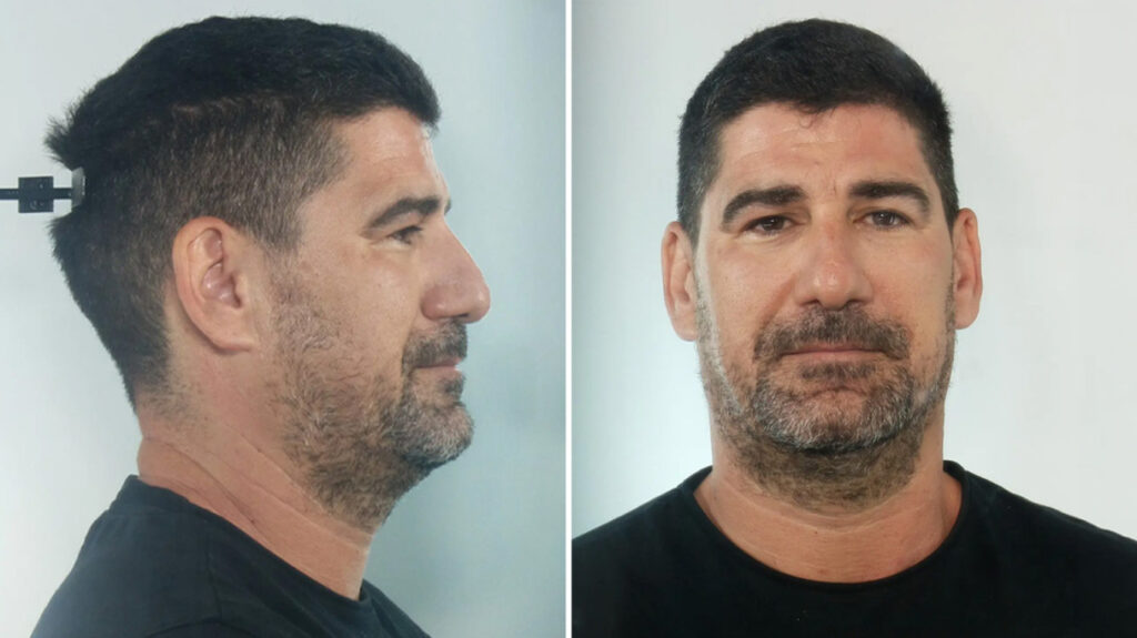 Για βιασμούς ανήλικων αθλητριών κατ’ εξακολούθηση διώκεται ο προπονητής στην Κεφαλονιά, στη δημοσιότητα τα στοιχεία του